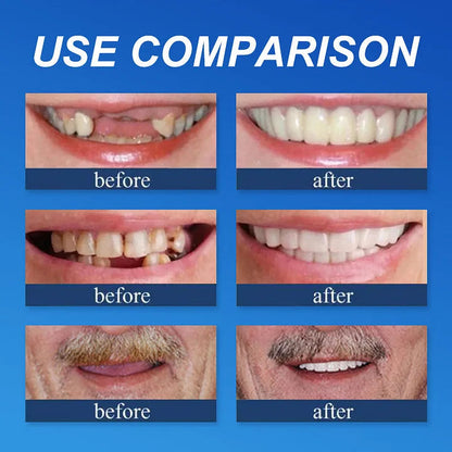 🌎Ends Today: 70% OFF! ⏰Cavebit™ Medical Full Denture with Strong Suctiond🦷Manufactured in FDA-registered facilities