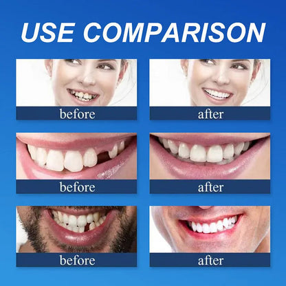 🌎Ends Today: 70% OFF! ⏰Cavebit™ Medical Full Denture with Strong Suctiond🦷Manufactured in FDA-registered facilities